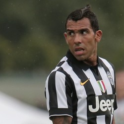 Tevez Tegaskan Cederanya Tak Parah