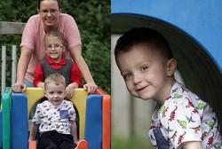 Bukan Sehat, Anak Ini Hanya Bisa Makan Wortel dan Pisang karena Alergi Langka