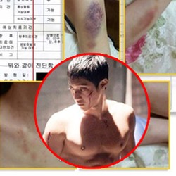 Mantan Pacar Cabut Gugatan Kasus Pemukulan Kim Hyun Joong