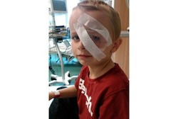 Karet Terpental Saat Bikin Loom Band, Bocah Ini Kehilangan Penglihatannya