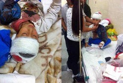 Bukannya Mengayomi, Guru Ini Pukuli Murid Sampai Tengkoraknya Retak