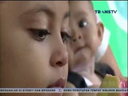 Menderita Tumor Mata, Bayi 9 Bulan Butuh Bantuan