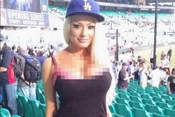 Kecanduan, Gadis Ini 3 Kali Operasi Payudara di Usia 23 Tahun