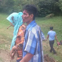 Kecelakaan Jagorawi, Banyak Korban Luka Masih Tergeletak di Pinggir Tol