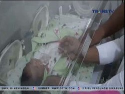 Kasihan, Bayi Ini Lahir Tanpa Dinding Perut