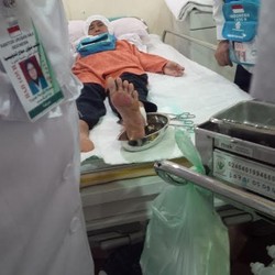 Percaya Mitos, Kaki Jamaah Haji Melepuh Saat Tiba di Tanah Suci
