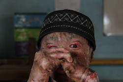 Ari Wibowo, Remaja Asal Tangerang yang Mendunia karena Berkulit Ular