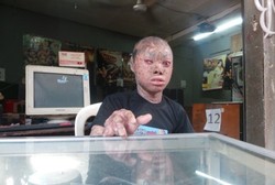 Keseharian Ari si Remaja Berkulit Ular: Jadi Penjaga Warnet