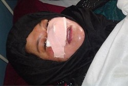 Tega! Pria Ini Potong Hidung Istri dengan Pisau Dapur