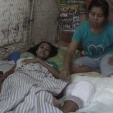 Remaja di Kediri ini Minta Doa agar Mampu Melawan Tumor di Kakinya