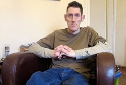 Sakit Langka, Tubuh Andrew Bisa Langsung Kaku Hanya Karena Kaget