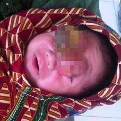 Tolong! Bayi Lukas Retak Batok Kepala hingga Organ Dalam Keluar