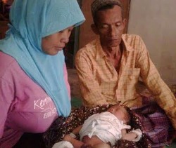 Bayi Lahir Tanpa Anus di Sumenep Tak Punya Biaya untuk Operasi