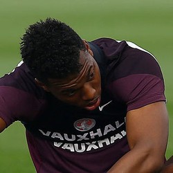 Liverpool Minta Timnas Inggris Jangan Panggil Sturridge Dulu