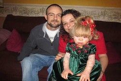 Sakit Kulit Langka, Georgia Hanya Bisa Main di Musim Dingin