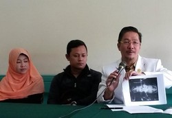 Bayi Kembar Siam Dempet Bokong Jalani Operasi Pemisahan di RSHS Bandung