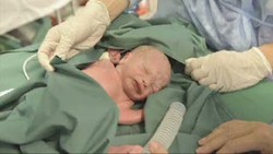 Pertama di Dunia, Bayi Lahir dari Transplantasi Rahim