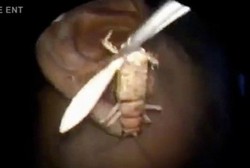 Kuping Gatal, Ternyata Jangkrik 7 Cm Ngumpet di Lubang Telinga