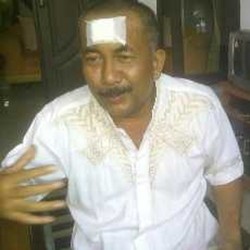 Dor! Pengacara Ditembak Orang tak Dikenal, Dahinya Terluka