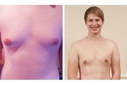 Bocah Laki-laki Ini Jual Mobil Demi Mengecilkan Payudaranya