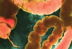 Cegah Diare, Ilmuwan Kembangkan Kapsul Berisi Feses