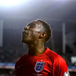 Kondisi Welbeck Baik-baik Saja