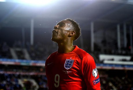 Kondisi Welbeck Baik-baik Saja