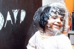 Ditemukan! Terapi Gen Sebagai Upaya Pengobatan Sindrom Bocah Gelembung