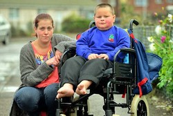 Berkaki Sumbing, Balita Ini Butuh Sepatu Khusus Seharga Rp 39 Juta