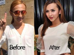 Dena Rachman, Before and After Implan Payudara