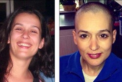 6 Tahun Dokter Salah Diagnosis, Luisa Meninggal karena Kanker Serviks