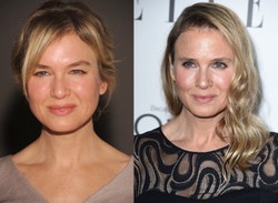 Tampil Berbeda, Renee Zellweger Diduga Operasi Plastik