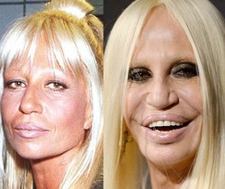 Foto: 10 Wajah Selebriti yang Berubah Drastis dari Masa ke Masa