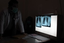 Ini yang Bisa Dilakukan Ahok untuk Bantu Kendalikan TBC di Jakarta