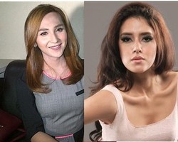 Fairuz Ngotot Cerai, Dena Ingin Hilangkan Jakun Usai Implan Payudara