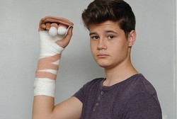 Iseng-iseng Main Kembang Api, Jari Tangan Remaja 15 Tahun Terbakar