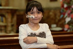 Alergi Antibiotik Langka, Bocah Ini Terbakar dari Dalam