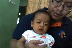 Deteksi Atresia Bilier: Periksa Warna Kuning di Kulit dan Feses Bayi