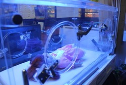 Butuh Inkubator untuk Rawat Bayi Berbobot Rendah? Anda Bisa Pinjam di Sini