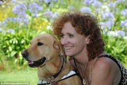 Buta di Usia 11 Tahun, Wanita Ini Bisa Melihat Lagi Setelah Terbentur Meja