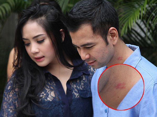 Ada Lipstik di Leher Raffi Ahmad