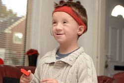 Tak Bisa Makan Permen dan Coklat, Lance Idap Penyakit Misterius