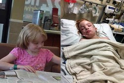 Tiba-tiba Lumpuh Karena Infeksi Otak Langka Selepas Vaksin Flu