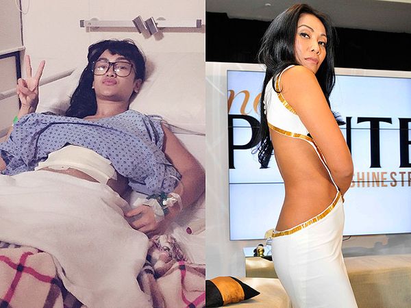 Penampilan Jupe Pasca Operasi, Anggun Seksi Pamer Punggung Penampilan Jupe Pasca Operasi, Anggun Seksi Pamer Punggung