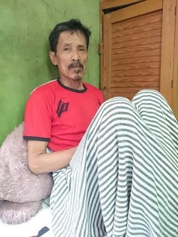 Heboh Kakek Bisa Bertelur? Dokter Bedah: Mungkin Dia Nelen Telur