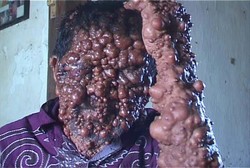 Slamet, Manusia Gelembung Asal Magetan Tutup Usia