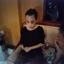 Derita Nuryati Jadi PRT: Tak Digaji, Babak Belur dan Tidur di Dapur