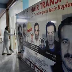 Transplantasi Rambut, Kegemaran Baru Pria Pakistan