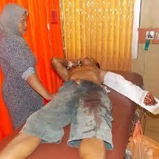 Seorang Pedagang di Probolinggo Jadi Korban Salah Tembak