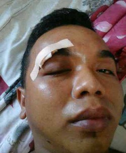 Langgar Rambu Lalin di Markas TNI AL, Dedi Babak Belur Dipukuli